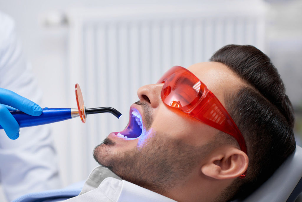 Metoda gabinetowa wybielania zębów to najszybszy sposób na uzyskanie wyjątkowego uśmiechu