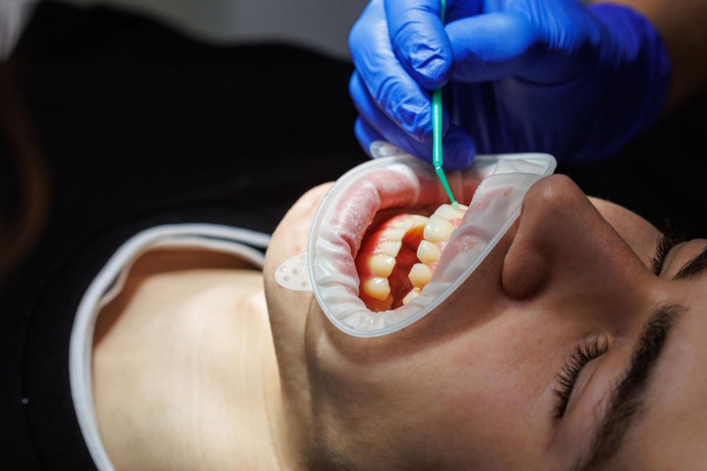 Jeśli masz problemy z zębem i potrzebujesz leczenia kanałowego, warto udać się do jednej z poznańskich klinik stomatologicznych