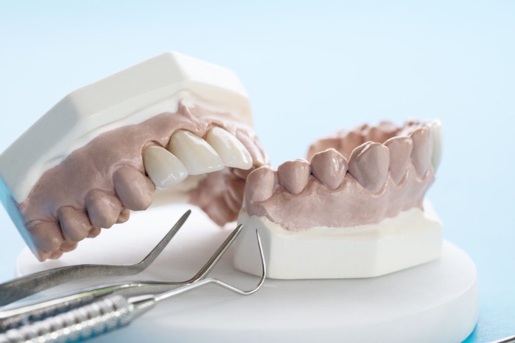 Protetyka stomatologiczna stale posuwa się naprzód, wprowadzając coraz to nowsze technologie